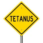 Mikor kell tetanusz?